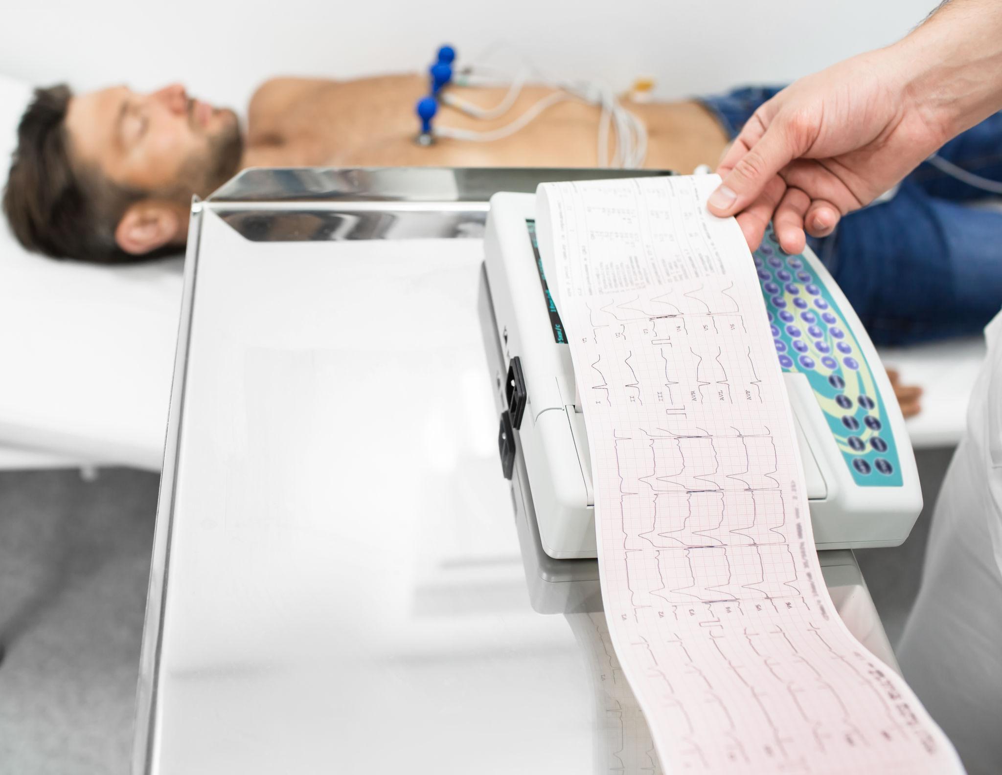 ECG