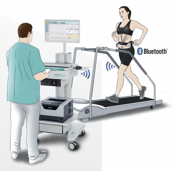 TMT Treadmill Test